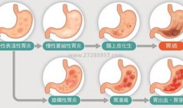 胃炎吃瓜和包米胃口疼,吃瓜與包米引發胃口疼痛