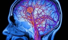 腦梗塞吃瓜尖,天然食療新選擇