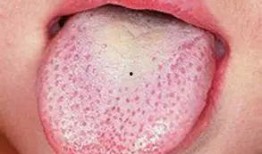 吃白瓜蟄舌頭,一場味蕾與自然的邂逅